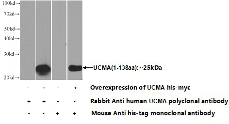 Transfected HEK-293 cells were subjected to SDS PAGE followed by western blot with Catalog No:116678(UCMA Antibody) at dilution of 1:1000