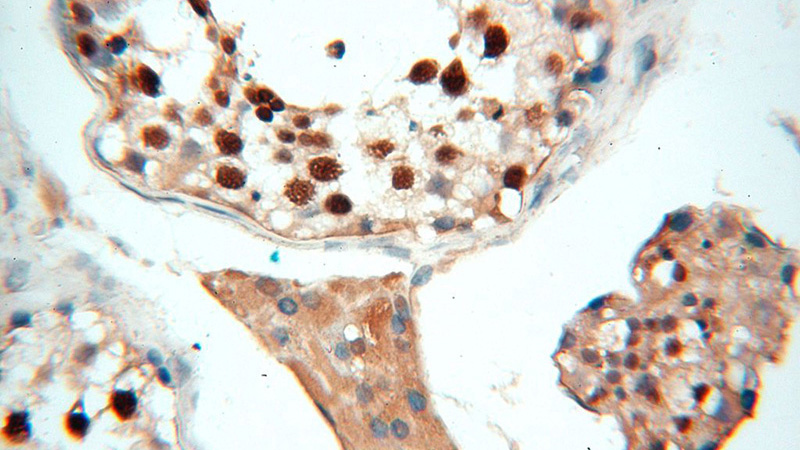 Immunohistochemical of paraffin-embedded human testis using Catalog No:115956(TEX11 antibody) at dilution of 1:100 (under 40x lens)