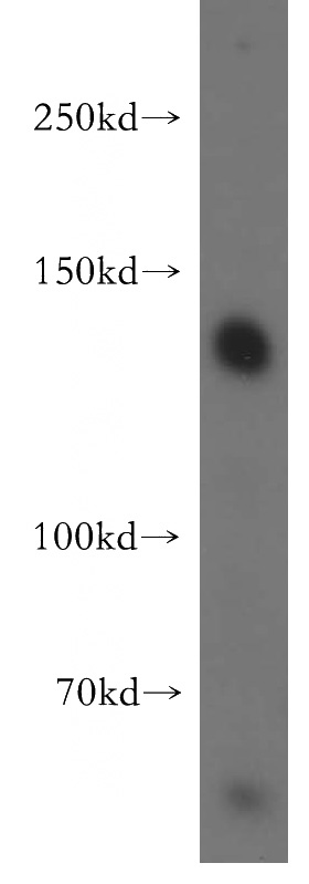 mouse brain tissue were subjected to SDS PAGE followed by western blot with Catalog No:115585(SRGAP1 antibody) at dilution of 1:800