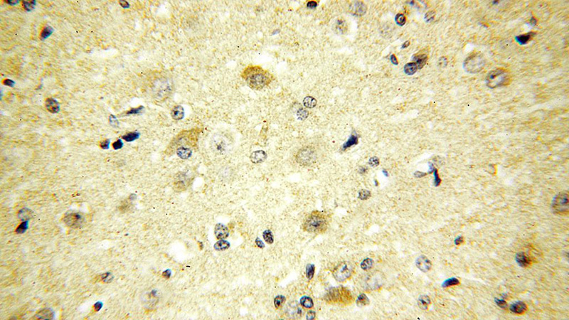 Immunohistochemical of paraffin-embedded human brain using Catalog No:113898(PIGT antibody) at dilution of 1:100 (under 40x lens)
