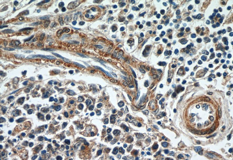 Immunohistochemistry of paraffin-embedded human spleen tissue slide using Catalog No:111344(TGFB1I1 Antibody) at dilution of 1:50 (under 40x lens)