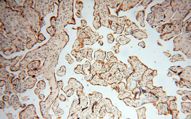 Immunohistochemical of paraffin-embedded human placenta using Catalog No:116584(USMG5 antibody) at dilution of 1:100 (under 10x lens)