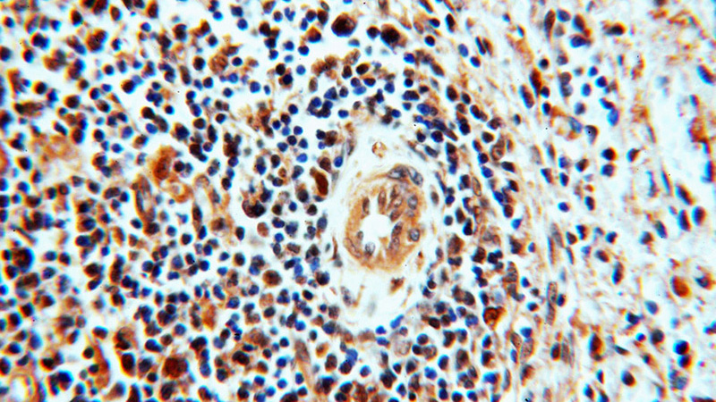 Immunohistochemical of paraffin-embedded human spleen using Catalog No:115696(STAT6 antibody) at dilution of 1:50 (under 40x lens)