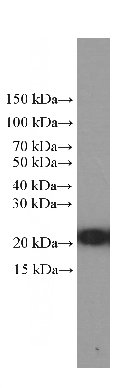 HeLa cells were subjected to SDS PAGE followed by western blot with Catalog No:107168(Cofilin Antibody) at dilution of 1:2000