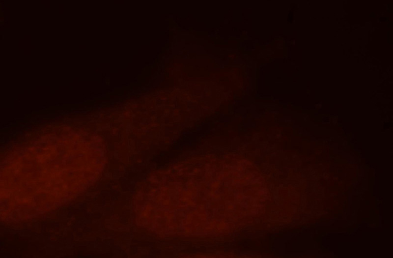Immunofluorescent analysis of HepG2 cells, using Catalog No:109170 and Rhodamine-labeled goat anti-rabbit IgG (red).