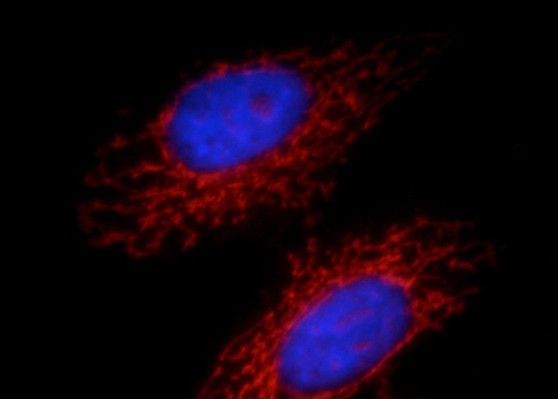 Immunofluorescent analysis of HepG2 cells, using NAGS antibody Catalog No:113017 at 1:25 dilution and Rhodamine-labeled goat anti-rabbit IgG (red). Blue pseudocolor = DAPI (fluorescent DNA dye).