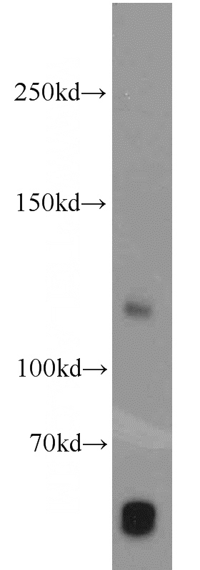 human placenta tissue were subjected to SDS PAGE followed by western blot with Catalog No:113839(PITRM1 antibody) at dilution of 1:300