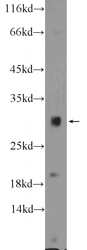 mouse kidney tissue were subjected to SDS PAGE followed by western blot with Catalog No:111359(HIST1H1T Antibody) at dilution of 1:300