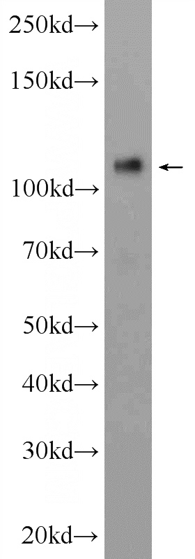 A375 cells were subjected to SDS PAGE followed by western blot with Catalog No:109054(CD146, MCAM Antibody) at dilution of 1:1000
