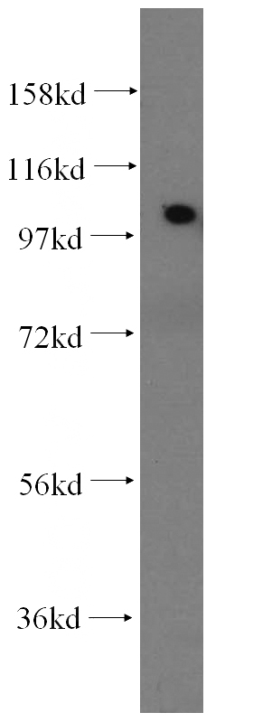 HeLa cells were subjected to SDS PAGE followed by western blot with Catalog No:107710(ACTN2 antibody) at dilution of 1:400
