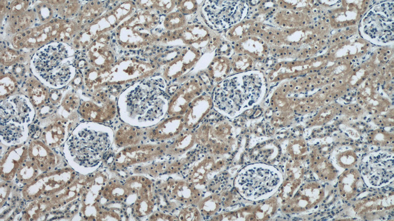 Immunohistochemical of paraffin-embedded human kidney using Catalog No:108950(CBY1 antibody) at dilution of 1:50 (under 10x lens)