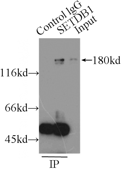 IP Result of anti-SETDB1 (IP:Catalog No:115130, 3ug; Detection:Catalog No:115130 1:1000) with MCF-7 cells lysate 2500ug.