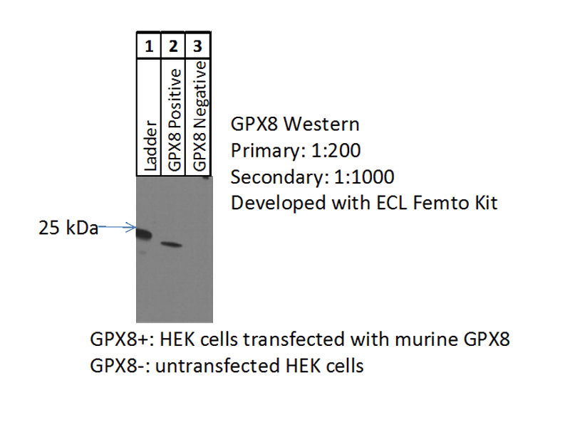 WB result of GPX8 antibody (Catalog No:111152, 1:200) with transfected HEK293 cells by Dr. Molly Keppel, Washington University.