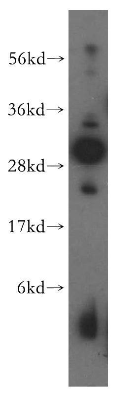 HeLa cells were subjected to SDS PAGE followed by western blot with Catalog No:113186(NIP30 antibody) at dilution of 1:500