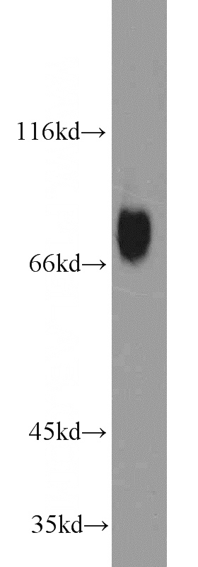 Jurkat cells were subjected to SDS PAGE followed by western blot with Catalog No:111556(HSF1 antibody) at dilution of 1:1000