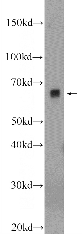 HeLa cells were subjected to SDS PAGE followed by western blot with Catalog No:113897(PIGS Antibody) at dilution of 1:300