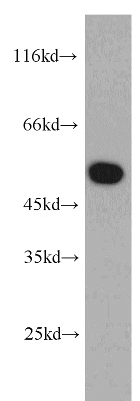 mouse liver tissue were subjected to SDS PAGE followed by western blot with Catalog No:112796(MTRF1 antibody) at dilution of 1:300