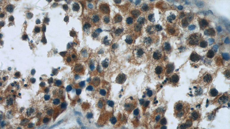 Immunohistochemistry of paraffin-embedded human testis tissue slide using Catalog No:111705(HSPH1 Antibody) at dilution of 1:50 (under 40x lens)