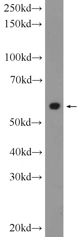 Jurkat cells were subjected to SDS PAGE followed by western blot with Catalog No:109694(CYP2E1-Specific Antibody) at dilution of 1:1000