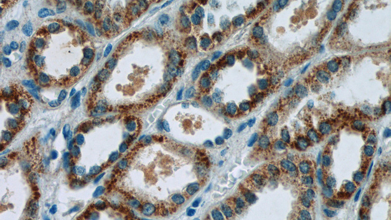 Immunohistochemistry of paraffin-embedded human kidney tissue slide using Catalog No:108970(CCDC27 Antibody) at dilution of 1:50 (under 40x lens)