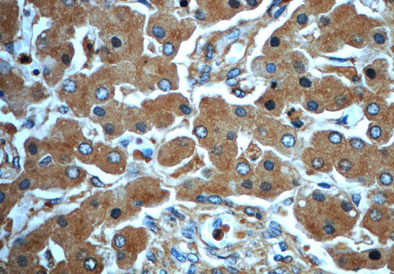 Immunohistochemistry of paraffin-embedded human liver slide using Catalog No:113425(ORM1 Antibody) at dilution of 1:50