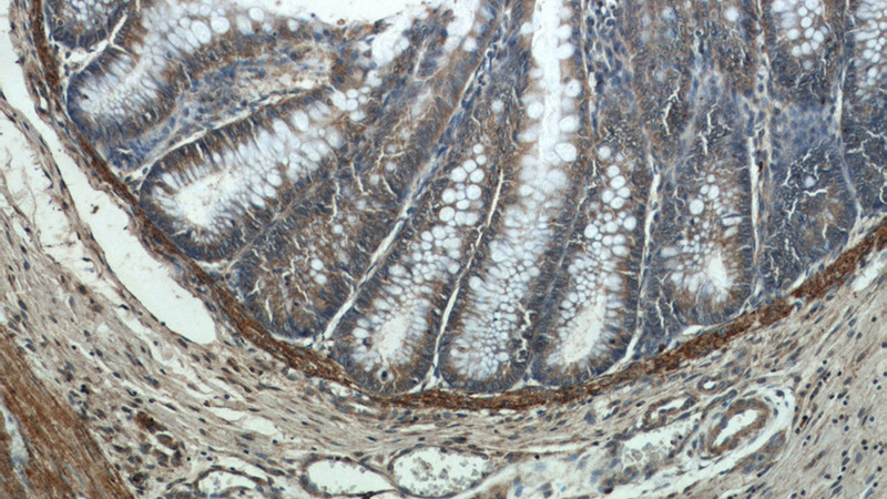 Immunohistochemistry of paraffin-embedded human colon tissue slide using Catalog No:111347(HIGD1B Antibody) at dilution of 1:50 (under 10x lens)