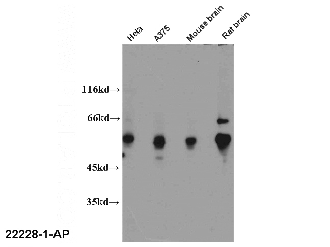 WB results of Catalog No:110711(FOXP3 antibody).