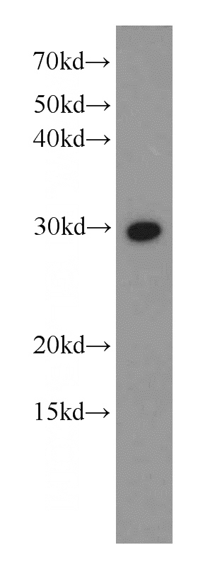 HEK-293 cells were subjected to SDS PAGE followed by western blot with Catalog No:115759(SYF2 antibody) at dilution of 1:600
