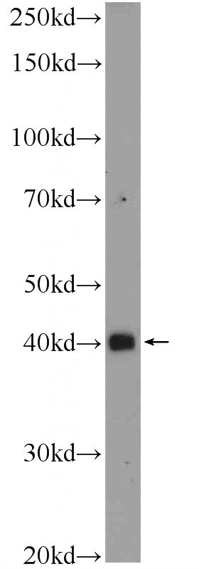 mouse kidney tissue were subjected to SDS PAGE followed by western blot with Catalog No:115422(SMAD7 Antibody) at dilution of 1:1000