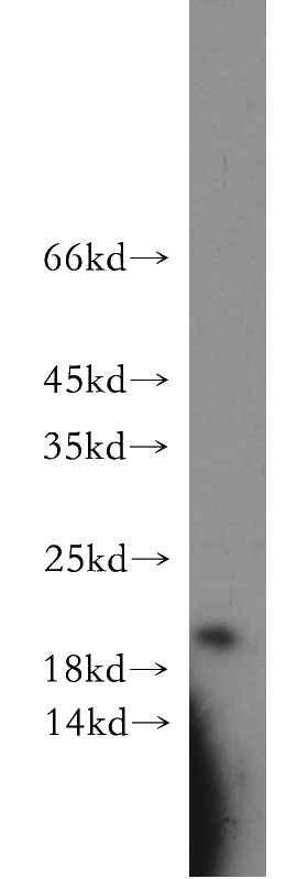 A549 cells were subjected to SDS PAGE followed by western blot with Catalog No:108044(APRT antibody) at dilution of 1:500