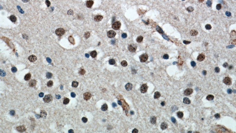 Immunohistochemical of paraffin-embedded human brain using Catalog No:108975(CCDC42 antibody) at dilution of 1:100 (under 40x lens)