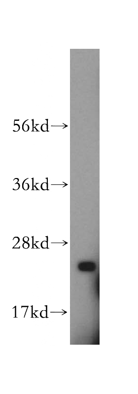 mouse liver tissue were subjected to SDS PAGE followed by western blot with Catalog No:108353(ATP5F1 antibody) at dilution of 1:1000
