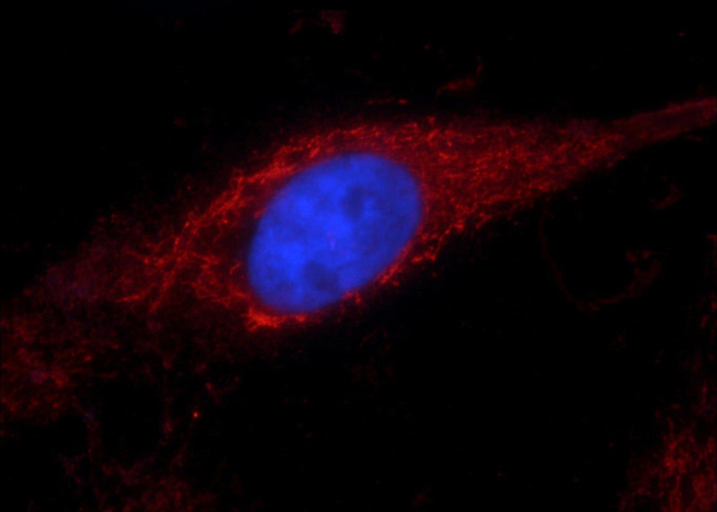 Immunofluorescent analysis of A431 cells using Catalog No:107570(ALDH1A1 Antibody) at dilution of 1:25 and Rhodamine-Goat anti-Mouse IgG