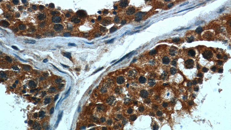 Immunohistochemical of paraffin-embedded human testis using Catalog No:107174(CPT1C antibody) at dilution of 1:50 (under 40x lens)