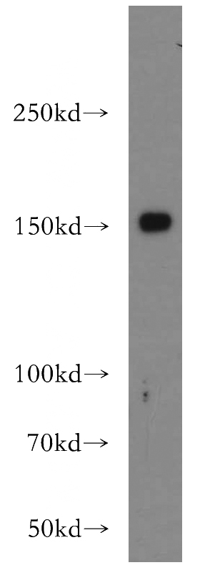 HepG2 cells were subjected to SDS PAGE followed by western blot with Catalog No:116203(TMF1-Specific antibody) at dilution of 1:300