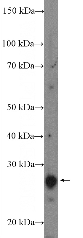 mouse brain tissue were subjected to SDS PAGE followed by western blot with Catalog No:114792(RP9 Antibody) at dilution of 1:600