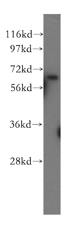 HepG2 cells were subjected to SDS PAGE followed by western blot with Catalog No:114097(PPP2R1A antibody) at dilution of 1:500