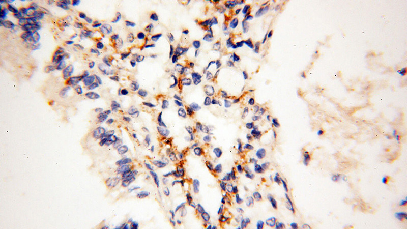 Immunohistochemical of paraffin-embedded human lung using Catalog No:112609(MICAL1 antibody) at dilution of 1:100 (under 40x lens)