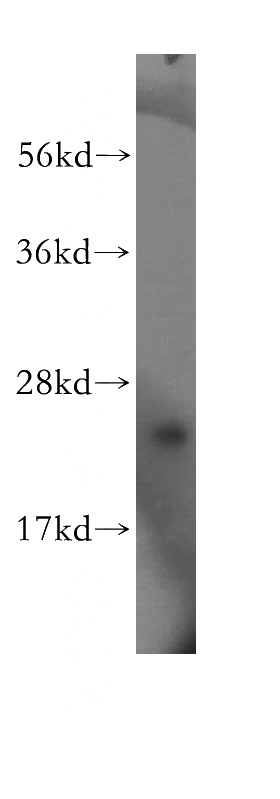 HepG2 cells were subjected to SDS PAGE followed by western blot with Catalog No:114890(RPL32 antibody) at dilution of 1:400