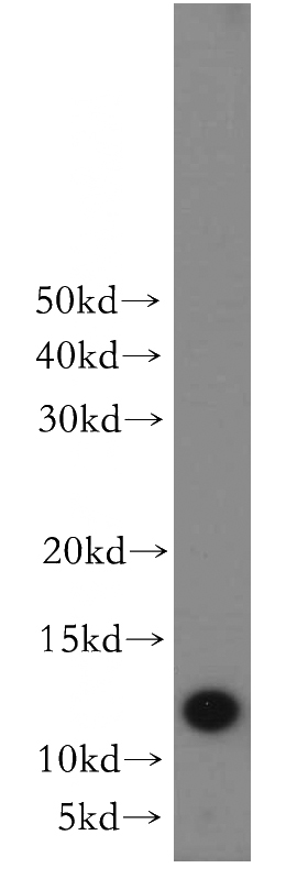 mouse skin tissue were subjected to SDS PAGE followed by western blot with Catalog No:109305(CHURC1 antibody) at dilution of 1:300