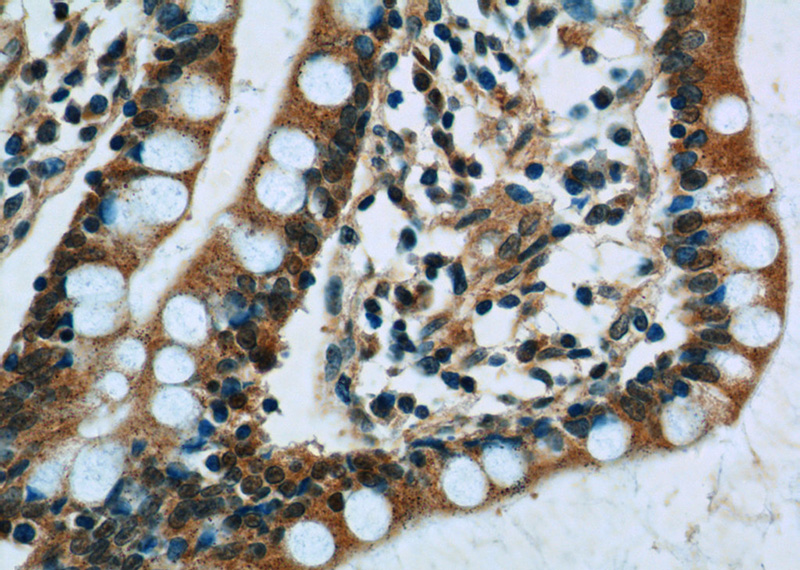 Immunohistochemistry of paraffin-embedded human small intestine tissue slide using Catalog No:115462(SNRPD3 Antibody) at dilution of 1:50 (under 40x lens)