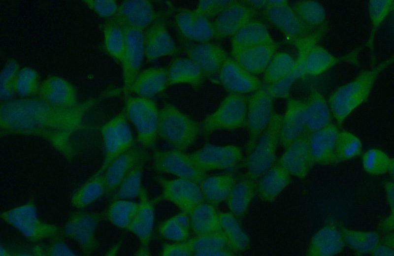 Immunofluorescent analysis of (10% Formaldehyde) fixed HEK-293 cells using Catalog No:109219(CHD3 Antibody) at dilution of 1:50 and Alexa Fluor 488-congugated AffiniPure Goat Anti-Rabbit IgG(H+L)