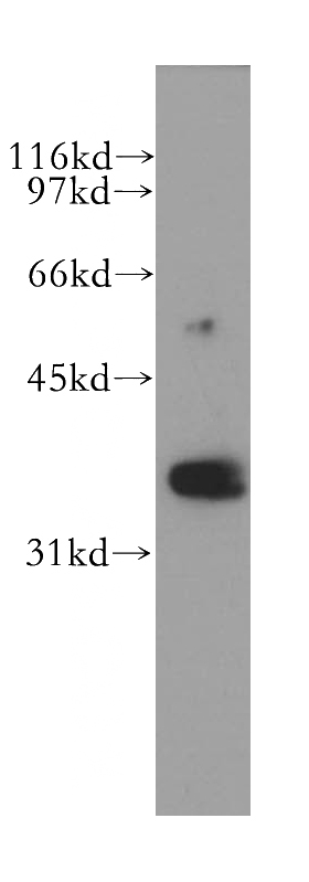K-562 cells were subjected to SDS PAGE followed by western blot with Catalog No:114665(RHOXF2 antibody) at dilution of 1:500
