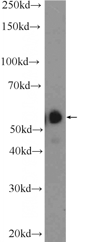 human testis tissue were subjected to SDS PAGE followed by western blot with Catalog No:115532(SPAG4-Specific Antibody) at dilution of 1:600