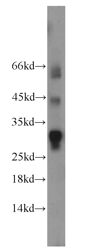 RAW264.7 cells were subjected to SDS PAGE followed by western blot with Catalog No:114814(RPL13A antibody) at dilution of 1:600