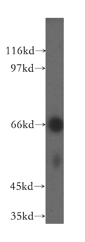 human spleen tissue were subjected to SDS PAGE followed by western blot with Catalog No:116474(UBASH3A-Specific antibody) at dilution of 1:400