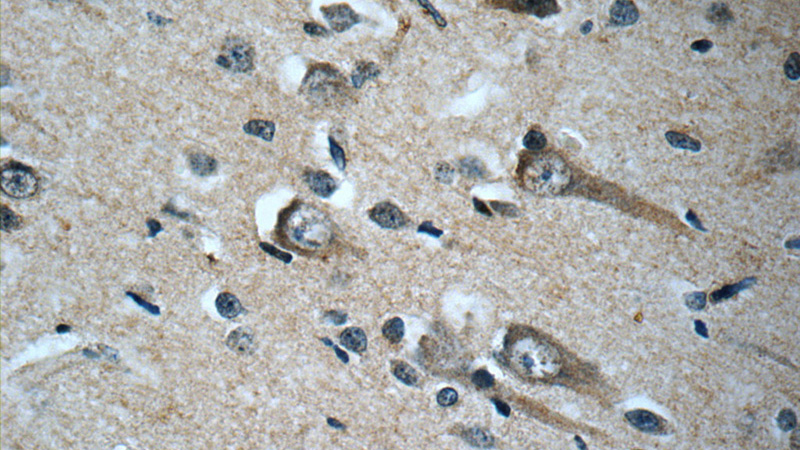 Immunohistochemistry of paraffin-embedded human brain slide using Catalog No:111078(SLC2A3 Antibody) at dilution of 1:50