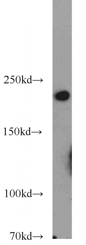 HL-60 cells were subjected to SDS PAGE followed by western blot with Catalog No:112938(Myh9 antibody) at dilution of 1:500