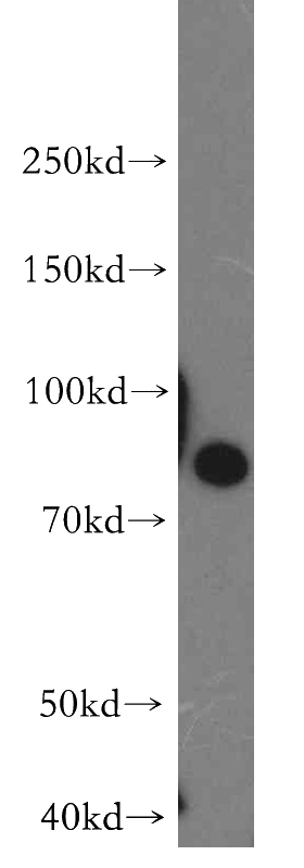 Jurkat cells were subjected to SDS PAGE followed by western blot with Catalog No:115707(STIM1 antibody) at dilution of 1:300