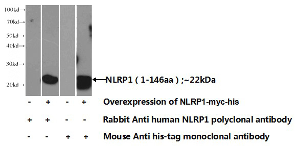 Transfected HEK-293 cells were subjected to SDS PAGE followed by western blot with Catalog No:113241(NLRP1 Antibody) at dilution of 1:1000